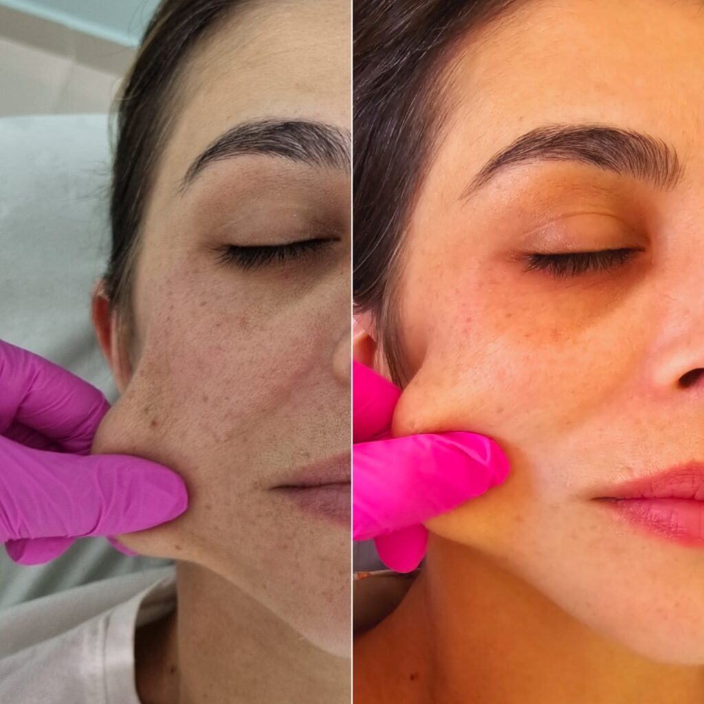 Dra. Patrícia Chagas | Harmonização Facial | Taubaté e Região
