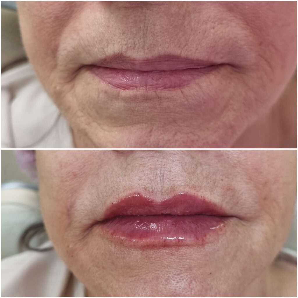 Dra. Patrícia Chagas | Harmonização Facial | Taubaté e Região