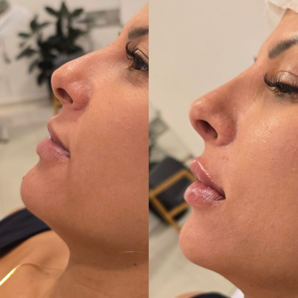 Dra. Patrícia Chagas | Harmonização Facial | Taubaté e Região