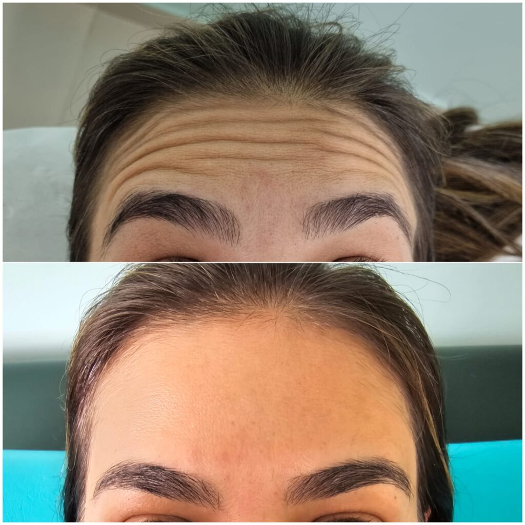 Dra. Patrícia Chagas | Harmonização Facial | Taubaté e Região