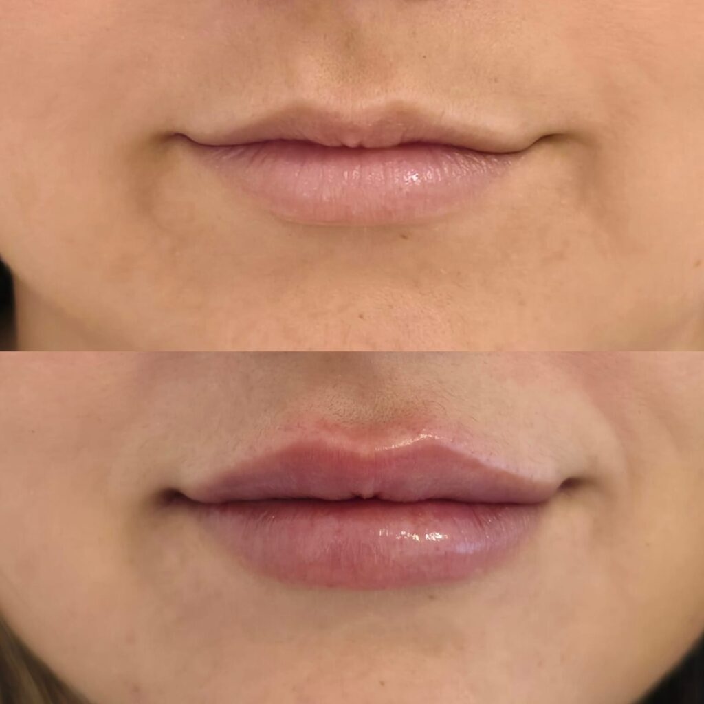 Dra. Patrícia Chagas | Harmonização Facial | Taubaté e Região