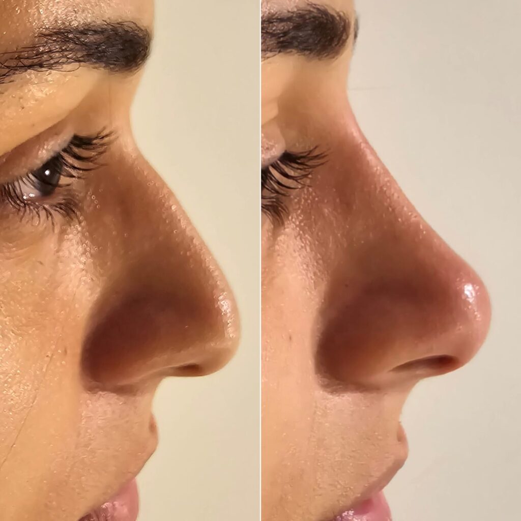 Dra. Patrícia Chagas | Harmonização Facial | Taubaté e Região